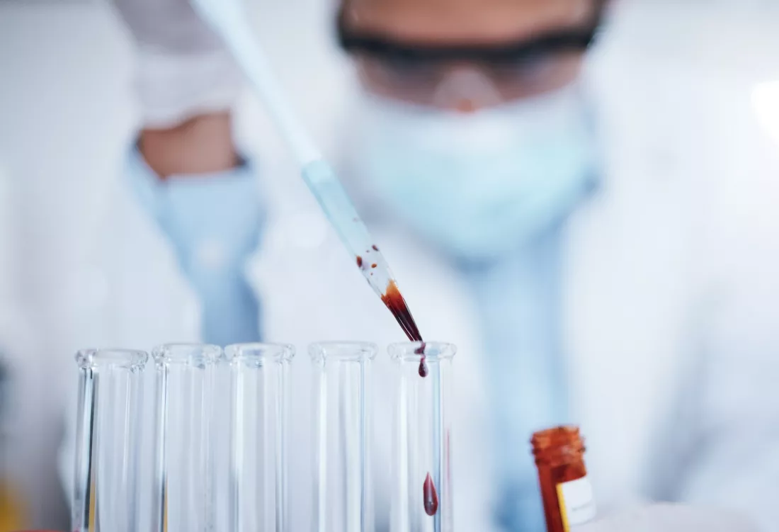 Eine Forscherin im Labor traeufelt mit einer Pipette eine Blutprobe in ein Reagenzglas.